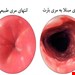  بارت مری