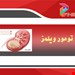  دانلود پاورپوینت پرستاری درمورد اختلالات کلیوی کودک بیمار ونگ