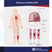   بیماری آمبولی ریوی کتاب داخلی جراحی 2018 پرستاری - Pulmonary Embolism