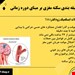  دانلود پاورپوینت پرستاری در مورد انواع سکته های مغزی و مراقبت های پرستاری مربوط به آنها