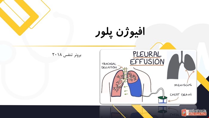 دانلود پاورپوینت پرستاری در مورد پلورال افیوژن یا افیوژن پلور- pleural effusion