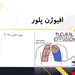  دانلود پاورپوینت پرستاری در مورد پلورال افیوژن یا افیوژن پلور- pleural effusion 