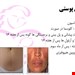  دانلود پاورپوینت پرستاری در مورد تشخیص حاملگی 