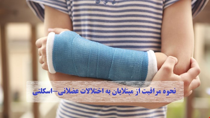 دانلود پاورپوینت پرستاری در مورد نحوه مراقبت از مبتلایان به اختلالات عضلانی-اسکلتی