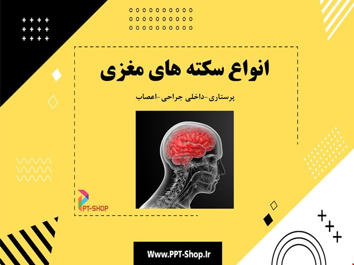 دانلود پاورپوینت پرستاری در مورد انواع سکته های مغزی و مراقبت های پرستاری مربوط به آنها