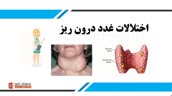 دانلود پاورپوینت پرستاری در مورد اختلالات غدد درون ریز 