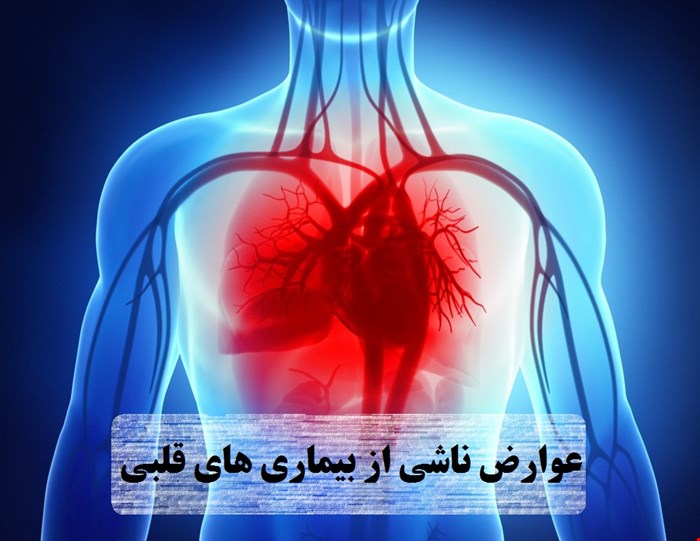 دانلود پاورپوینت پرستاری در مورد مراقبت از بیماران مبتلا به عوارض ناشی از بیماری های قلبی