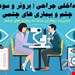 برونر چشم 2022- پاورپوینت