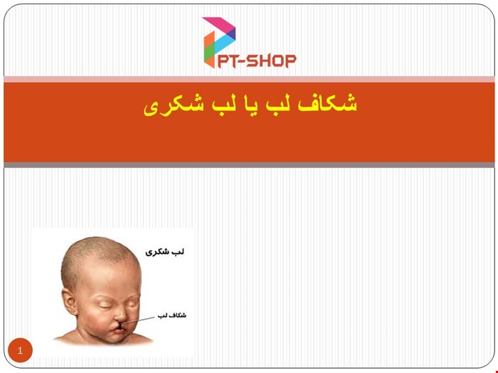 دانلود پاورپوینت پرستاری درمورد شکاف لب یا لب شکری 