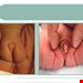 ابهام جنسی - کودک بیمار ونگ