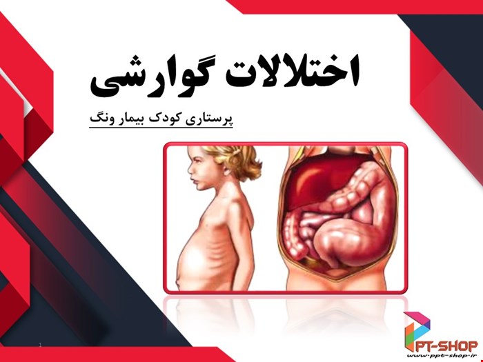 دانلود پاورپوینت پرستاری در مورد اختلالات گوارشی 