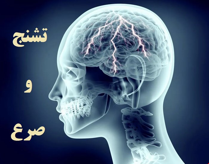 دانلود پاورپوینت پرستاری در مورد اختلالات تشنجی