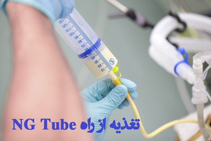 دانلود پاورپوینت پرستاری در مورد تغذیه از راه لوله و مراقبت های پرستاری آن
